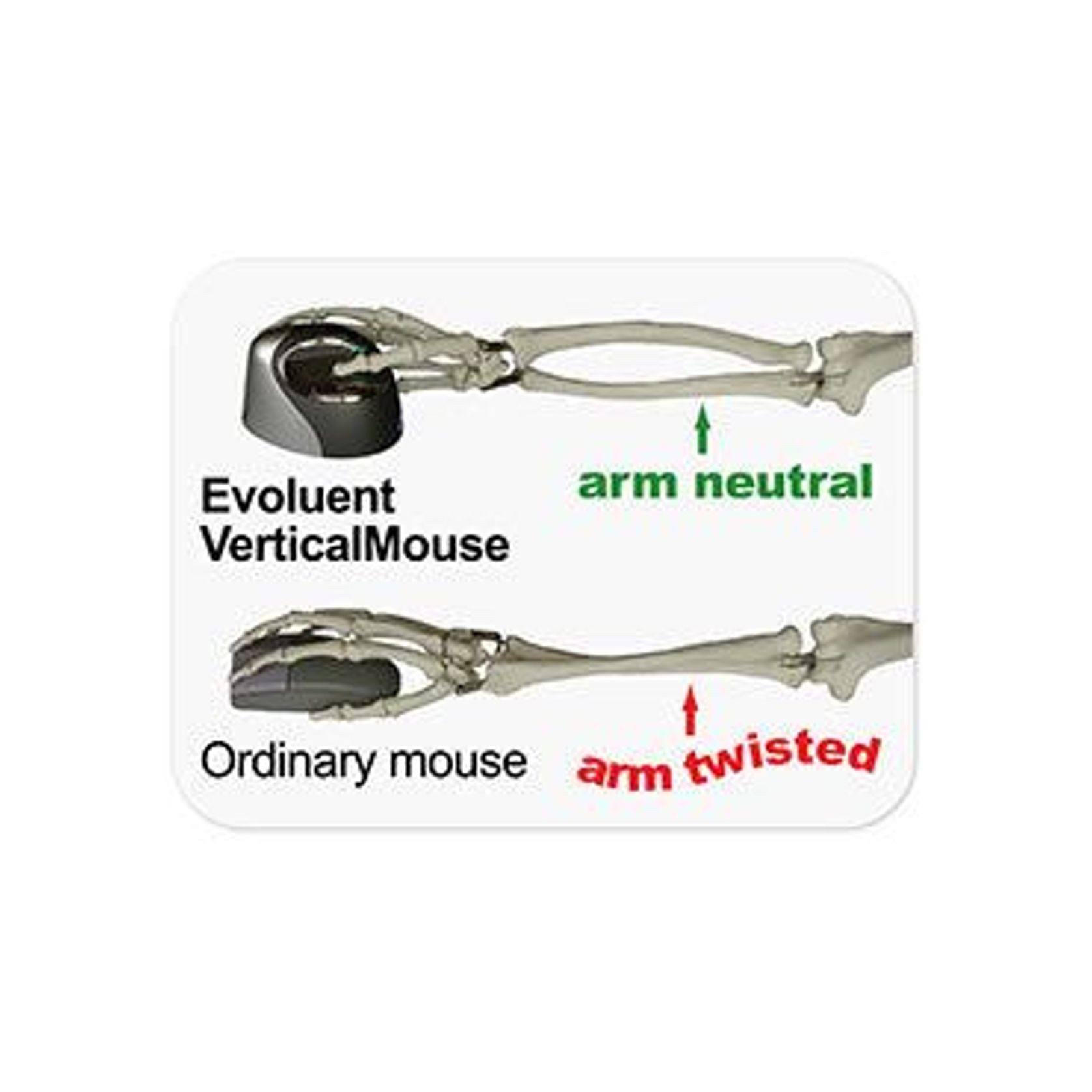 Evoluent Vertical Mouse gallery detail image
